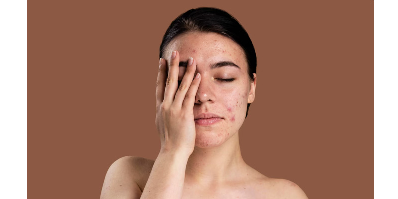 Nhiều người nhiễm viêm gan C còn phải đối mặt với các bệnh lý về da