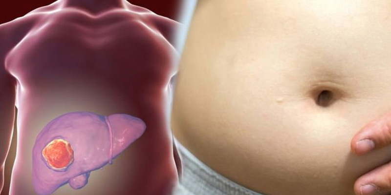 Những triệu chứng phổ biến thường gặp ở ung thư gan giai đoạn cuối 