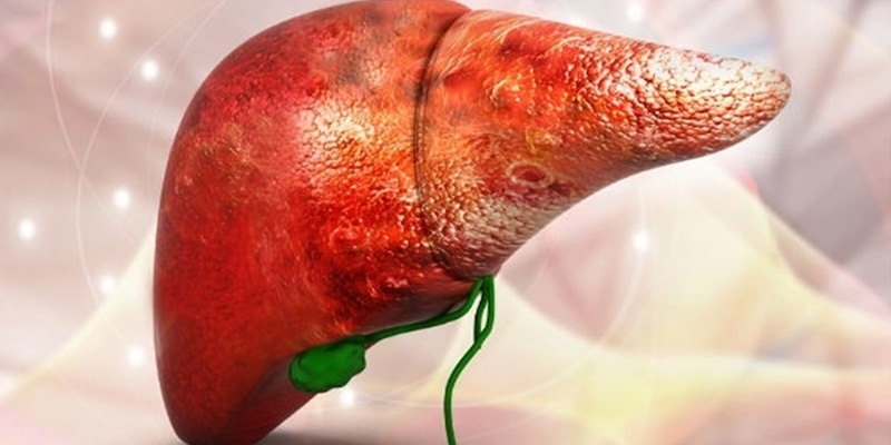 Ung thư gan giai đoạn cuối thường được tiên lượng xấu