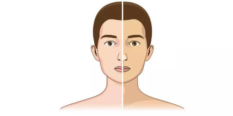 Khi xuất hiện tình trạng vàng da, người bệnh cần đi khám sức khỏe ngay lập tức để được chẩn đoán và điều trị kịp thời.