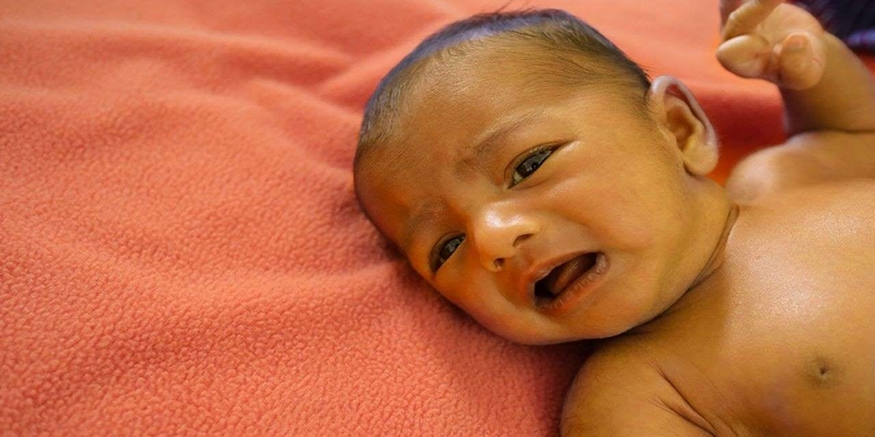 Ứ mật ở trẻ sơ sinh thường do dị dạng hoặc teo đường mật bẩm sinh