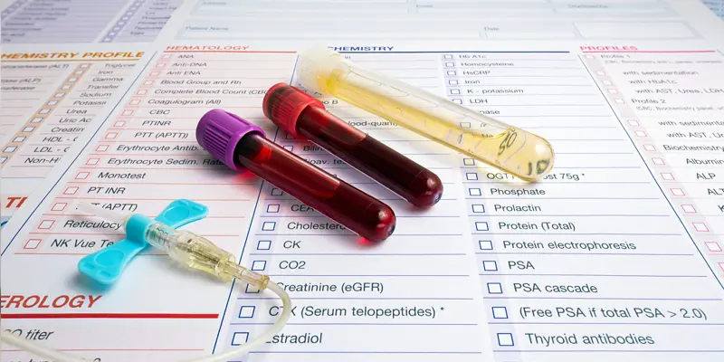 Xét nghiệm marker ung thư gan