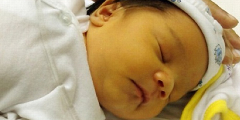 Vàng da là triệu chứng khi trẻ mắc ung thư nguyên bào gan