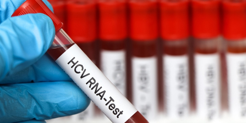 Xét nghiệm định lượng HCV RNA có vai trò quan trọng trong chẩn đoán và theo dõi điều trị