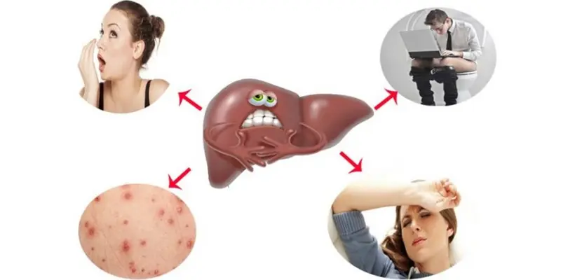 Cần phải giải độc gan thường xuyên để bảo vệ lá gan và sức khỏe