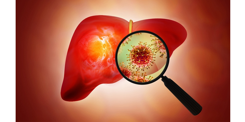 Loại virus gây bệnh sẽ ảnh hưởng đến việc người viêm gan B có thể béo hay không
