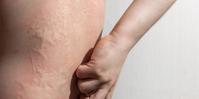 Tâm lý bất ổn sẽ làm trầm trọng thêm tình trạng viêm gan