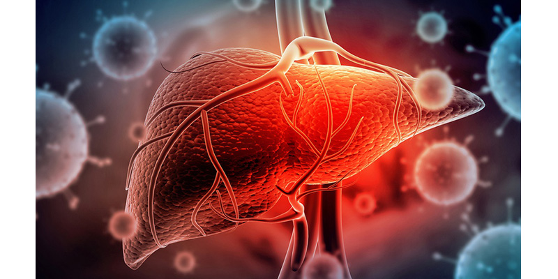 Bệnh viêm gan B do virus viêm gan B (HBV) gây ra