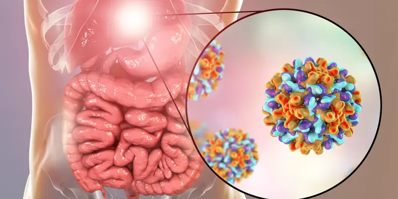 Viêm gan B là bệnh do virus HBV gây ra