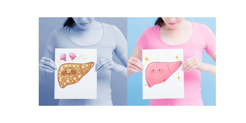 Viêm gan B mãn tính là giai đoạn tiến triển nặng hơn của bệnh viêm gan B