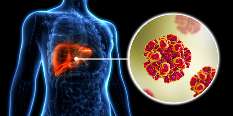 Người mắc viêm gan B sống được bao lâu là câu hỏi thắc mắc của nhiều người
