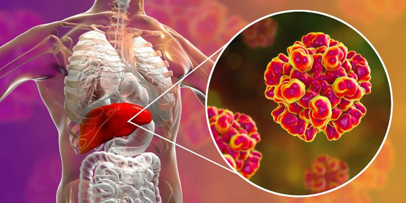 Viêm gan E có thể gây nguy hiểm đến sức khỏe