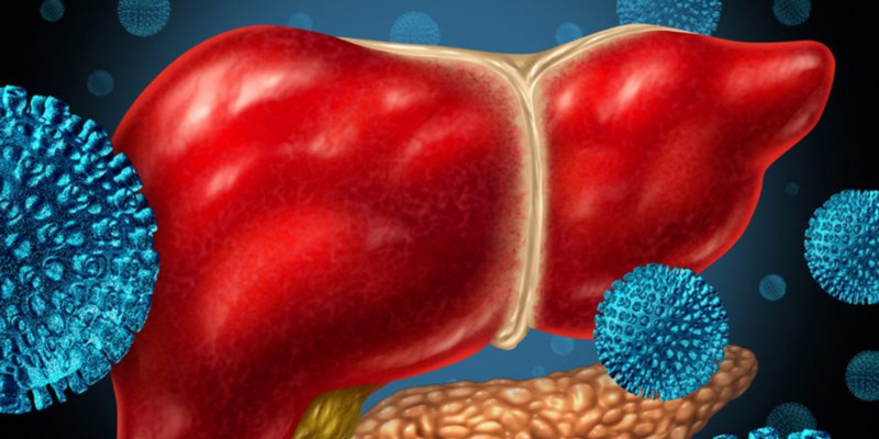 Viêm gan E là bệnh do virus HEV gây ra
