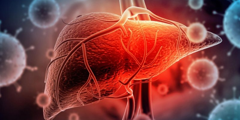 Viêm gan là bệnh lý do virus viêm gan xâm nhập vào gan và gây tổn thương gan