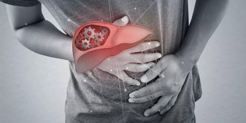 Viêm màng bụng là triệu chứng giai đoạn 3 của bệnh xơ gan