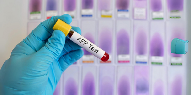 AFP không chỉ giúp phát hiện ung thư gan mà còn giúp theo dõi sự tiến triển của bệnh.