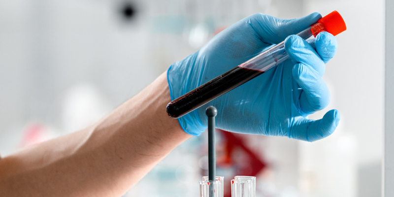 Xét nghiệm chức năng gan cơ bản bao gồm các chỉ số phổ biến như ALT, AST, GGT, Bilirubin, Albumin
