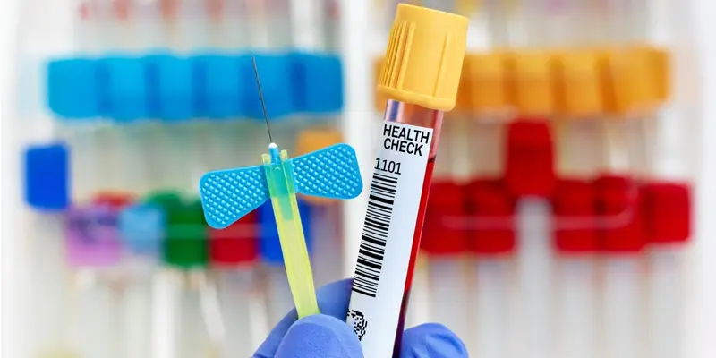 Xét nghiệm chức năng gan là phần không thể thiếu khi xét nghiêm viêm gan C