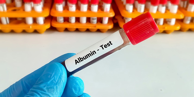 Xét nghiệm để chẩn đoán xơ gan