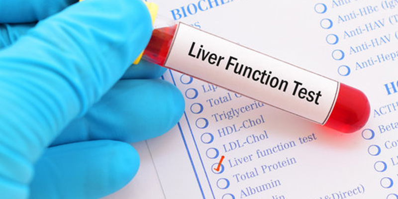 Chỉ số men gan cao cảnh báo bệnh lý về gan