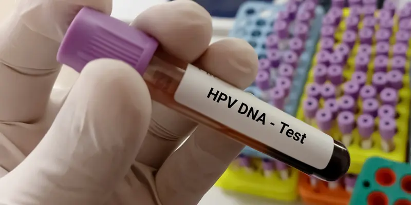 Xét nghiệm HBV DNA trước khi điều trị viêm gan B mạn tính