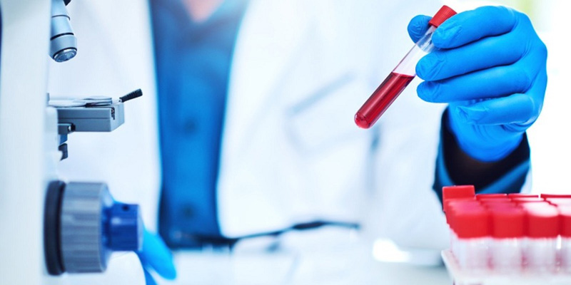 Xét nghiệm HEV là một trong những phương pháp giúp hỗ trợ chẩn đoán bệnh viêm gan E