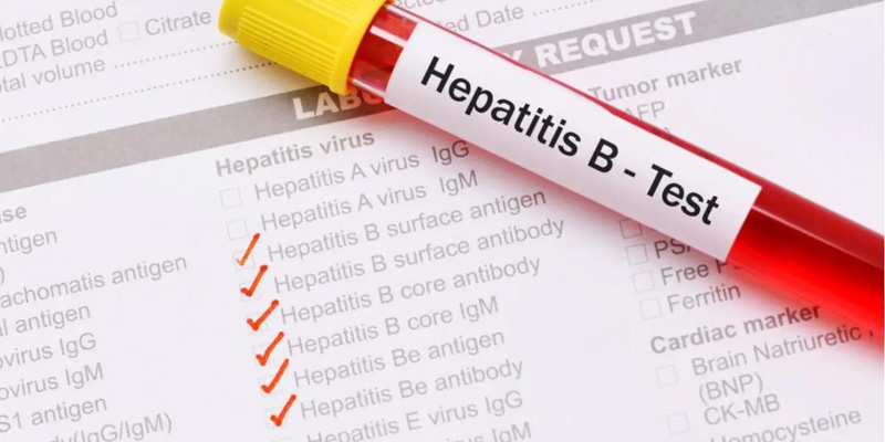 Xét nghiệm viêm gan B để có thể xác định bệnh cụ thể