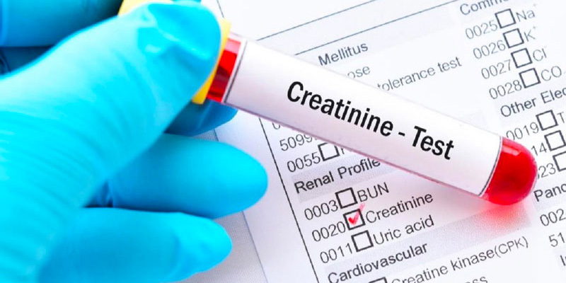 Xét nghiệm Creatinin cũng là phương pháp để bác sĩ chẩn đoán bệnh xơ gan