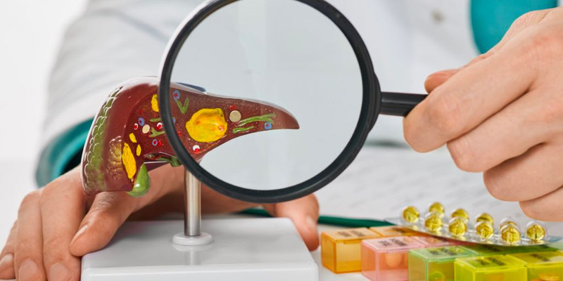 Tìm hiểu về bệnh xơ gan