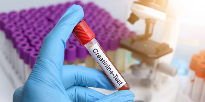 Người bệnh cần thực hiện một số xét nghiệm máu để chẩn đoán bệnh xơ gan do rượu