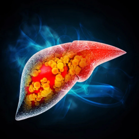 Người ăn chay cũng có thể bị gan nhiễm mỡ: Nguyên nhân do đâu?