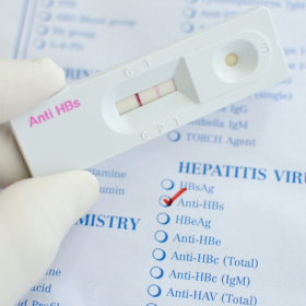 Anti HBs là gì? Ai nên xét nghiệm và chỉ số Anti HBs bao nhiêu là an toàn?