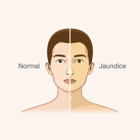 Các dấu hiệu gan có vấn đề và cách phòng ngừa.