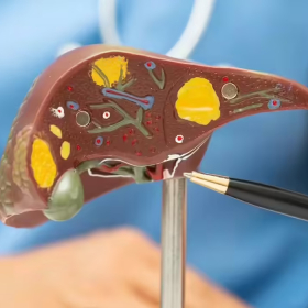 Cơ chế bệnh sinh xơ gan? Đối tượng nào có nguy cơ cao bị xơ gan