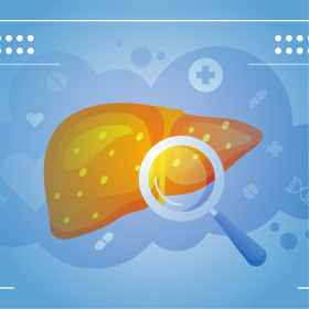 Gan nhiễm mỡ độ 1 có nguy hiểm không? Các rủi ro cần biết