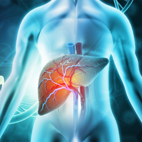 Gan nhiễm mỡ độ 2: Nguyên nhân, dấu hiệu và phòng ngừa