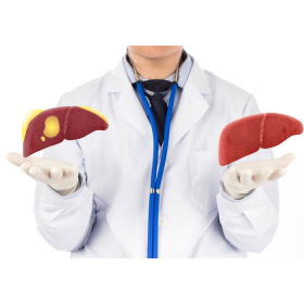 Gan nhiễm mỡ nhẹ và những lưu ý cần biết