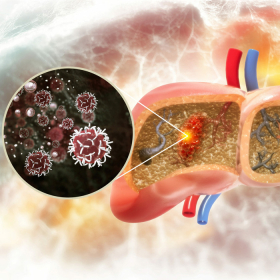 Gan nhiễm mỡ trung bình là gì? Hiểu đúng để điều trị hiệu quả