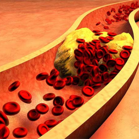 Gan nhiễm mỡ và máu nhiễm mỡ: Mối liên hệ ít ai biết