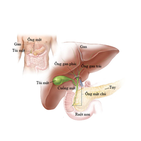 Giãn đường mật trong gan: Nguyên nhân, triệu chứng và điều trị hiện nay