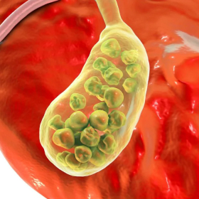 Tình trạng giãn đường mật trong gan có nguy hiểm không?