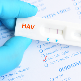 HAV IgM là gì? Hướng dẫn cách đọc kết quả xét nghiệm
