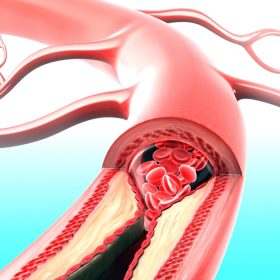 Hội chứng gan phổi là gì? Nguyên nhân, triệu chứng và cách điều trị