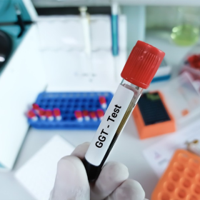 Men gan GGT tăng trong các trường hợp nào?