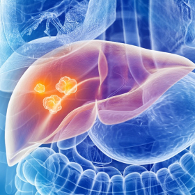 Quy trình thực hiện nút mạch gan, ưu nhược điểm của nút mạch gan