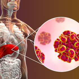 Tổng quan phác đồ điều trị viêm gan C hiện nay