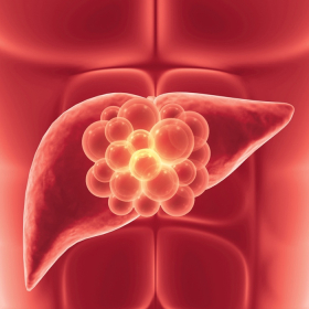 Phân biệt viêm gan B thể hoạt động và thể không hoạt động dễ hiểu nhất