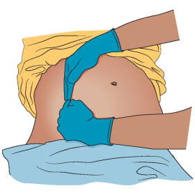 Giải đáp: Vì sao suy dinh dưỡng gây xơ gan và cách phòng ngừa