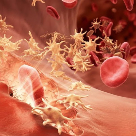 Triệu chứng của bệnh xơ gan xuất huyết tiêu hóa và cách nhận biết