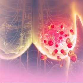 Giải đáp: Ung thư vú di căn gan sống được bao lâu